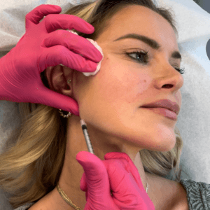 Foundation in Bloom (Collagen Stimulator Jawline and Cheeks)