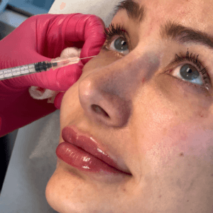 Radiant Eyes Refresh (Under-Eye Rejuvenation Treatment)