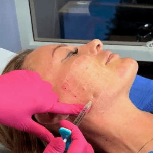 Dewy Spring Skin (SkinVive)