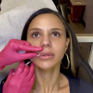 Lip, Cheeks, and Tox