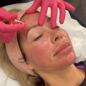 Golden Hour Glow Facial/ For Radiant Glassy Skin
