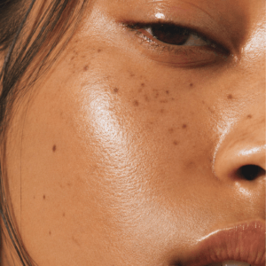 Summer Skin Reset