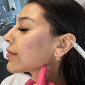 A Neck Above (Lower Face + Neck Package)