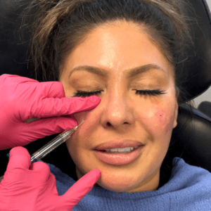 Bright Eyes (UnderEye Treatment)